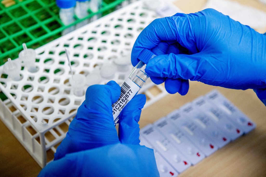 STUDIU. Testele rapide sunt ineficiente și duc la răspândirea pandemiei. „În România sunt, în mod real, 100.000 de cazuri pe zi”