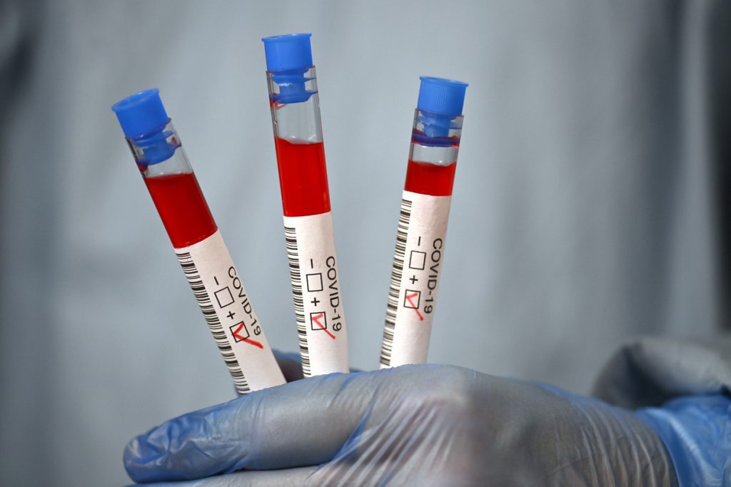 BILANȚUL ZILEI: Scade numărul de infectări și decese zilnice