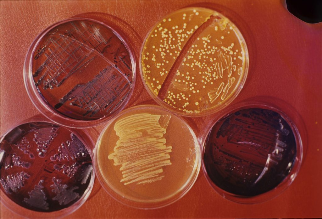 Bacteria „Legionella” a fost identificată ca fiind cauza unor misterioase epidemii de pneumonie în Argentina