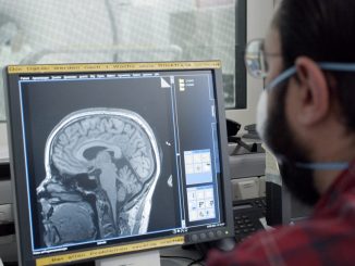 STUDIU. Simptomele de demență apar cu nouă ani înainte de diagnosticare