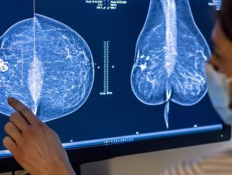 STUDIU. Inteligența Artificială îmbunătățește predicția cancerului mamar